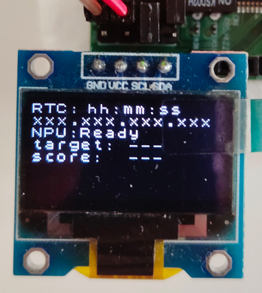 W55RP20 smart doorbell